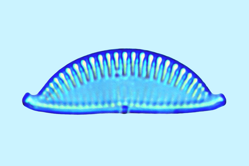 Amphora Amphora turgida